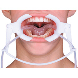Cheek separator