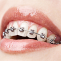 Orthodontie
