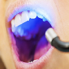 comprar blanqueador dental para casa