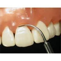 prophylaxis
