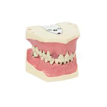 A-PB: Maxilla and Mandible Model for Periodontics