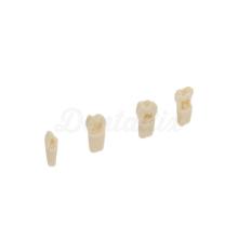 Model Teeth for Children's Denture Models