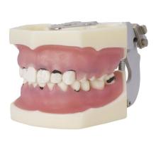 Type of articulated periodontics