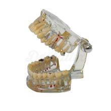 Tipodonto Multi-Dental Illness Demonstration