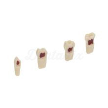 AK62Z: Model of Temporary Dental Pieces for Preparations (10ud)