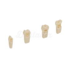 AK62Z: Model of Temporary Dental Pieces for Preparations (10ud)