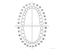 Juego de Dientes con Tornillos para Tipodonto A-3 (32 dientes)