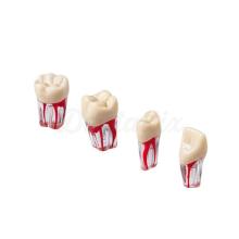 Dentes Endo para Prática