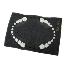Replacement of Pediatric Nissin teeth