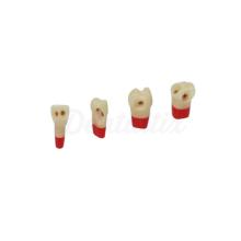 AG3ZSDPK.300V1: Permanent Dental Pieces For Preparations No.24 (10ud)