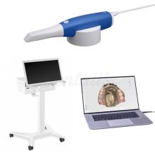 i600: Scanner intraorale