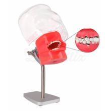 Periodontic Phantom for Table