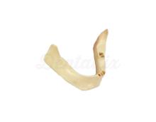 Edentulous Jaw with Simulated Nerves