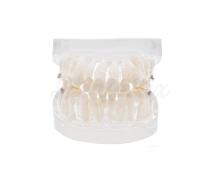 Dental Model: Orthodontic Practice