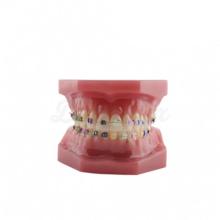 Typodont con brackets metallici