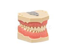 AG-3 Z Stable Intercuspidation Oral Hygiene Model