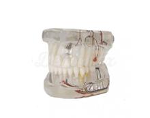 Nerve implant demonstration model