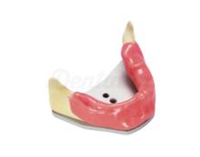 Model A-J KWA for Implant Practice (Edentulous Jaw + Gingiva and Mounting Plate)