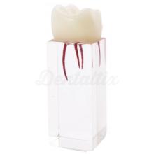 Molar for endodontics