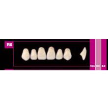 Cosmo HXL: Upper Anterior Acrylic Teeth (6 units)