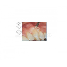 GINGIVAL RETRACTORS