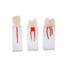 Set di denti Endo per gli studi