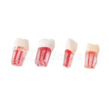Set of Transparent Teeth with Ducts