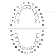 AG-3 ZE: Tooth Set for Typodont AG-3 (10 pcs)