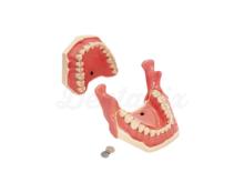 AG-3 IB: Typodont for local anesthesia practices
