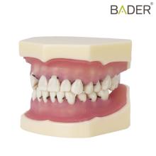 Periodontal Type