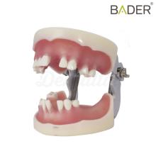 Toothless Typodont with Articulator