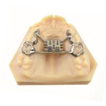 Terminale dentale CAD-CAM a vite ad espansione rapida