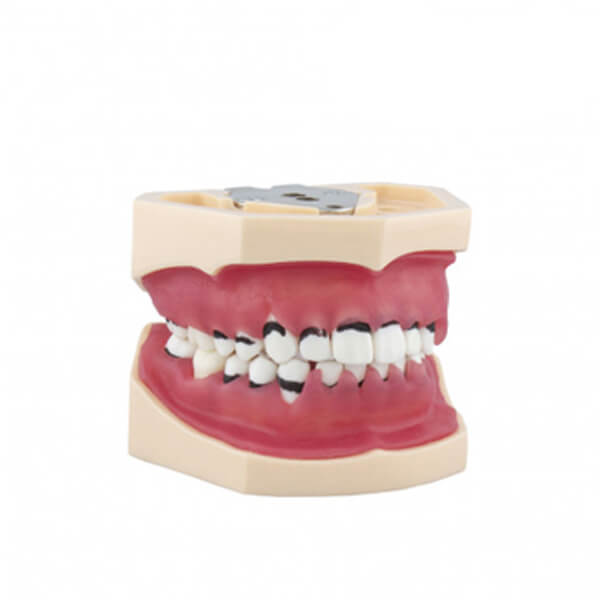 Complete Periodontics Model